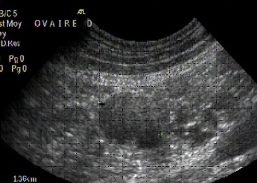 Infertilit Chez Une Chienne Un Cas De Kyste Ovarien R solu Infertilit Chez Une Chienne Un Cas De Kyste Ovarien R solu